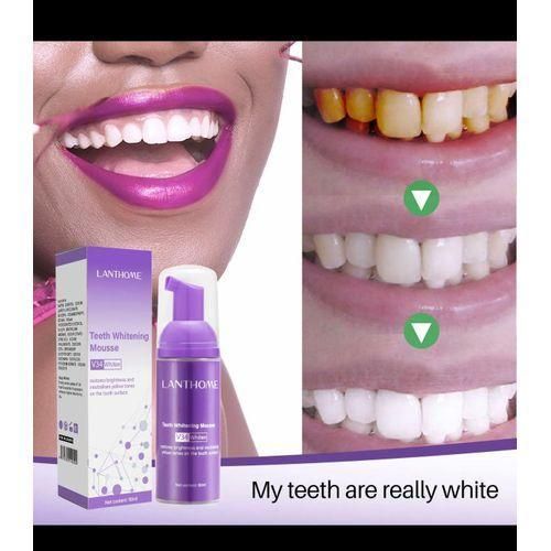 Lanthome V34 teeth whitening and stain remover