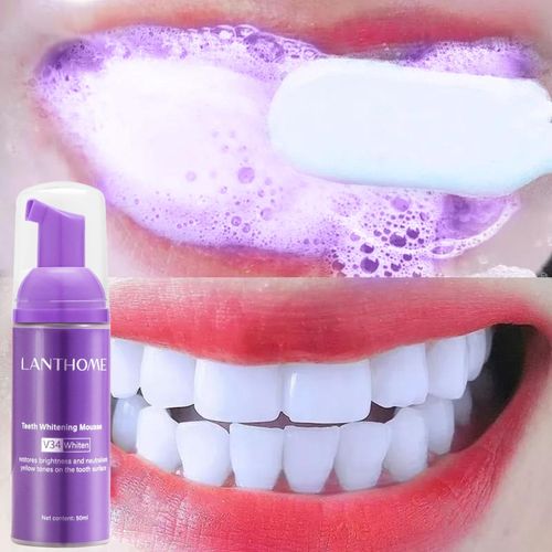 Lanthome V34 teeth whitening and stain remover